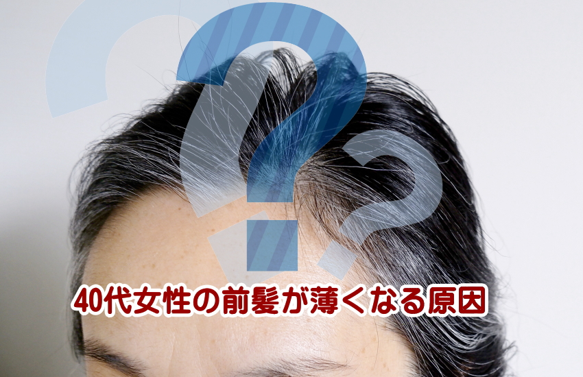 40代女性の前髪が薄い原因