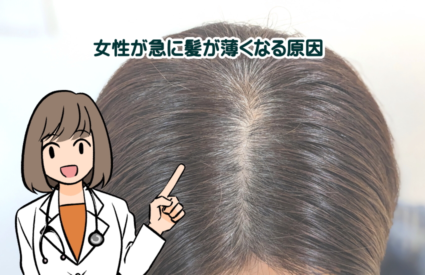 急に髪が薄くなった女性　原因